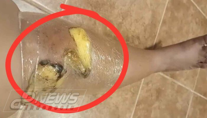 Diduga Diberangkatkan Non-Prosedural, PMI Asal Karawang di Oman Sakit Parah dan Minta Dipulangkan